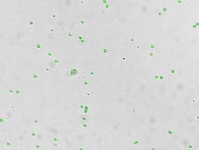 Bright Field Counted Image Primary Mouse Bone Marrow Cells