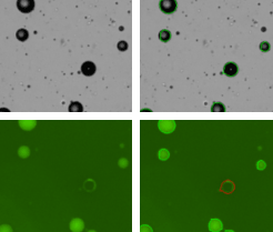 Detection of GFP-labeled Adipocytes