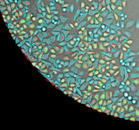 Brightfield image 96-well microplate showing counted adherent cells.