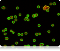 fluorescent jurkat counted cell image
