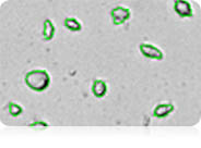 Count irregular-shaped cells